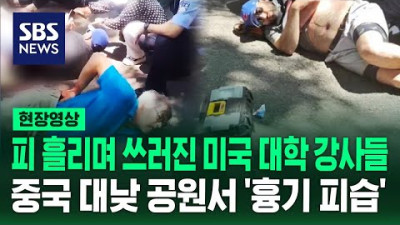 대낮 중국 공원서 미국 대학 강사들 '흉기 피습'…미 국무부 예의 주시